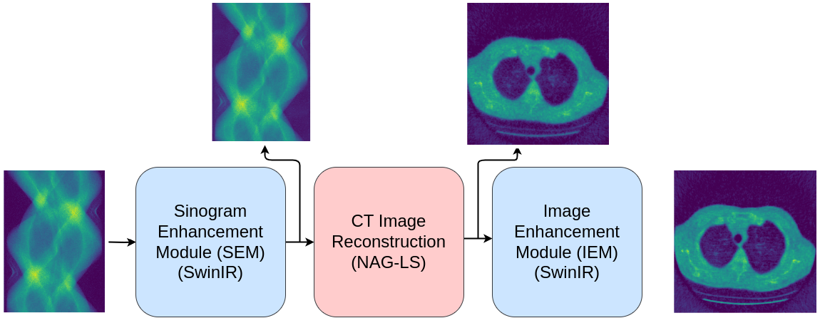 3D CBCT Challenge 2024: Improved Cone Beam CT Reconstruction Using SwinIR-Based Sinogram and Image Enhancement